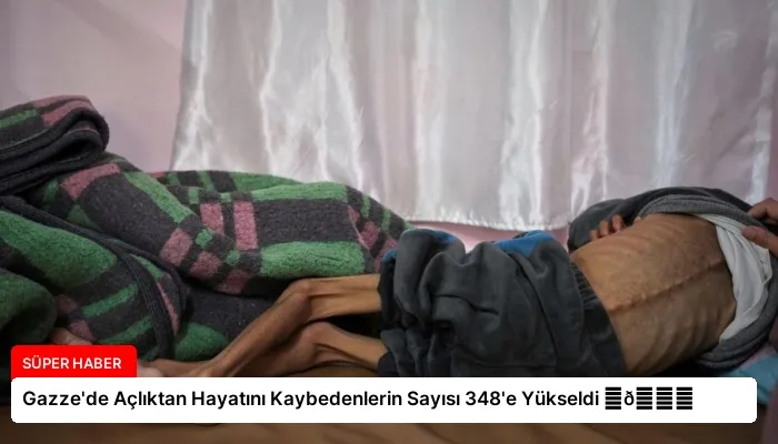 Gazze’de Açlıktan Hayatını Kaybedenlerin Sayısı 348’e Yükseldi ⏬👇